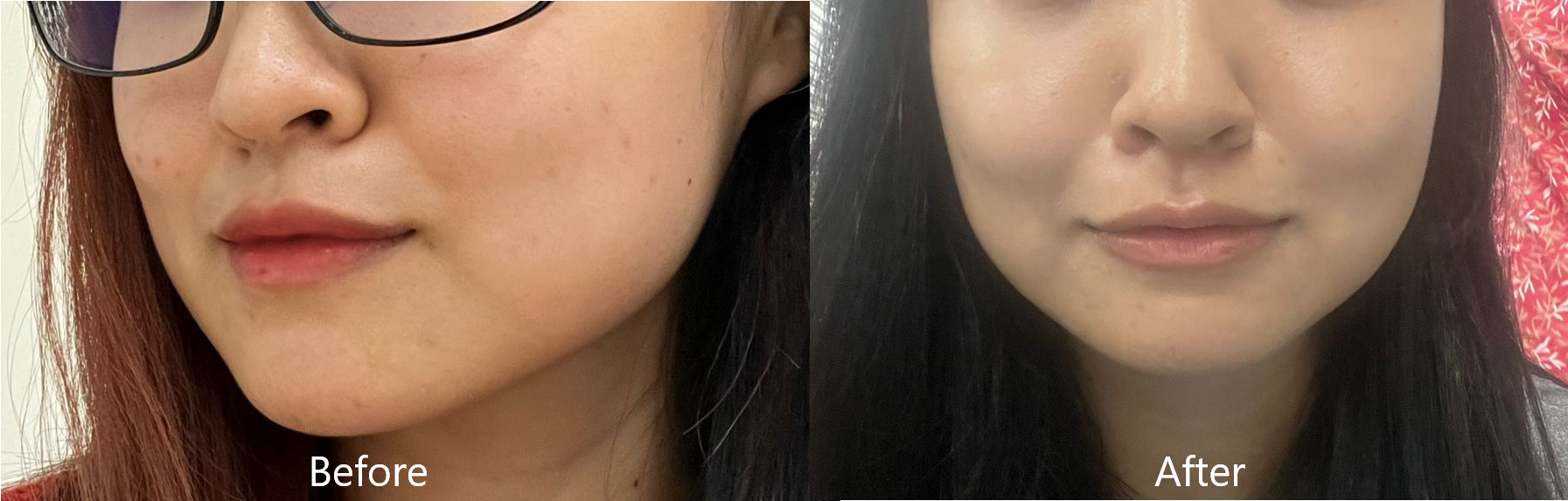 "I could see a huge improvement in my skin condition since using Putryana. Some of my favourite products include its Vitamin C Serum -  Cnoline, which helped reduce the appearance of my acne scars along my chin while keeping the texture smooth and radiant."